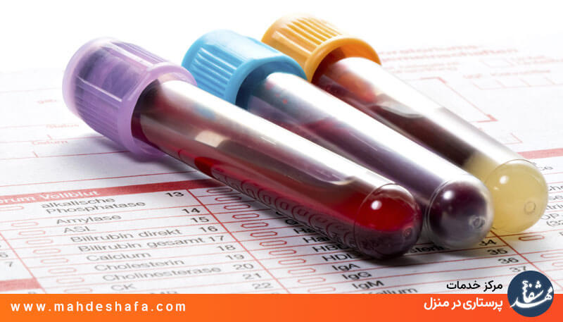 خدمات-آزمایشگاهی-در-منزل
