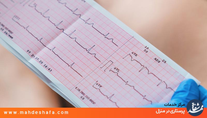 نوار قلب خانگی برای بررسی سلامت قلب
