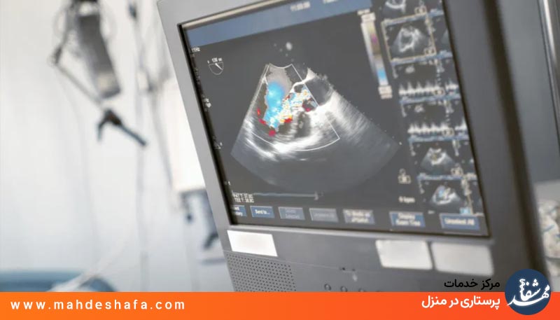 اکوی قلب در منزل با تجهیزات پیشرفته