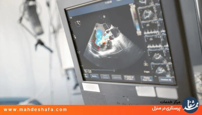 اکوی قلب در منزل با تجهیزات پیشرفته
