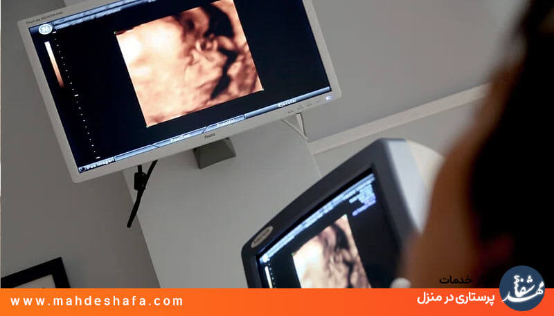 دستگاه سونوگرافی خانگی پیشرفته