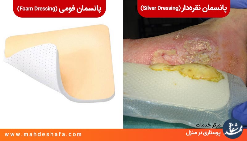 پانسمان-فومی-و-پانسمان-نقره-دار