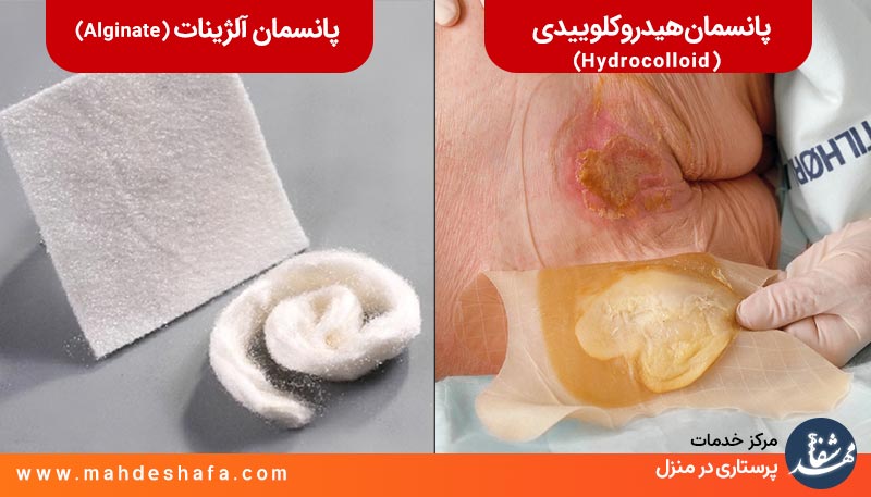 پانسمان-هیدروکلوییدی-و-پانسمان-آلژینات