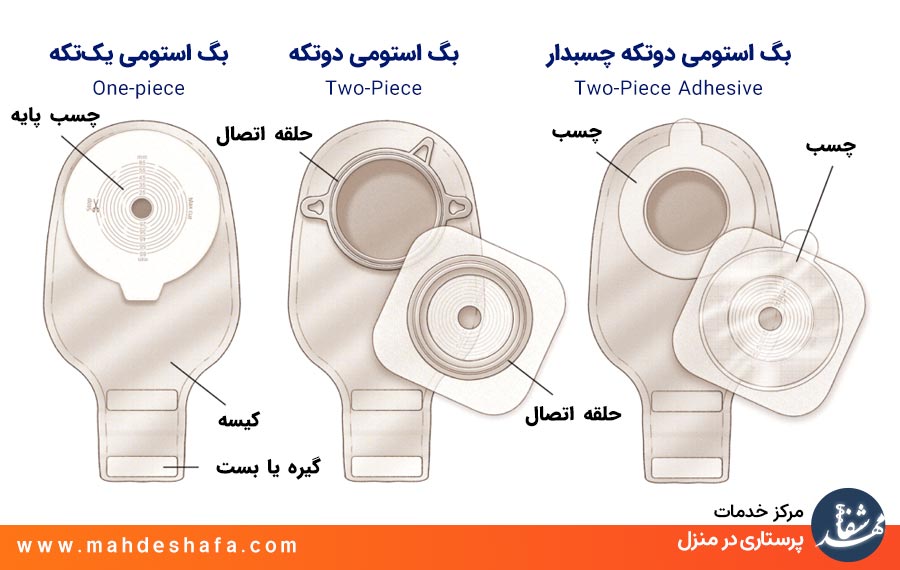 انواع-بگ-های-استومی-دو-تکه-و-یک-تکه