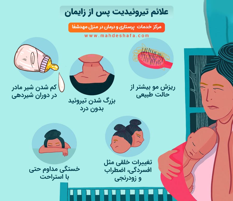علائم-تیروییدیت-پس-از-زایمان